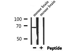 Image no. 2 for anti-beta-Transducin Repeat Containing (BTRC) (N-Term) antibody (ABIN6260326)