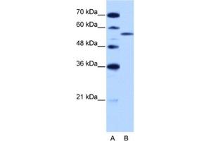 Image no. 1 for anti-Zinc Finger (CCCH Type), RNA-Binding Motif and serine/arginine Rich 2 (ZRSR2) antibody (ABIN2462182)