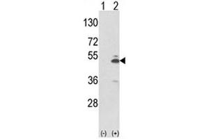 Image no. 4 for anti-Pyruvate Kinase M2 (PKM2) (AA 116-145) antibody (ABIN3032239)