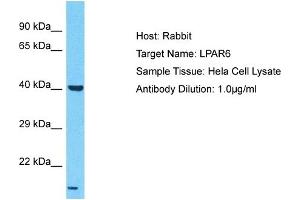 Image no. 1 for anti-Lysophosphatidic Acid Receptor 6 (LPAR6) (N-Term) antibody (ABIN2790482)