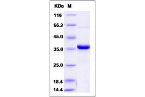 Image no. 1 for Protein tyrosine Phosphatase, Non-Receptor Type 2 (PTPN2) (AA 1-314) (Active) protein (ABIN2003080)