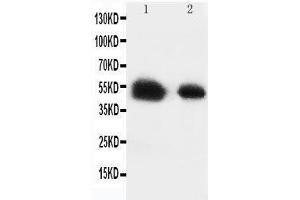 Image no. 3 for anti-Solute Carrier Family 2 (Facilitated Glucose Transporter) Member 8 (SLC2A8) (AA 461-477), (C-Term) antibody (ABIN3043992)