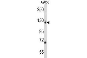 Image no. 2 for anti-Elongation Factor Tu GTP Binding Domain Containing 2 (EFTUD2) (AA 263-293), (Middle Region) antibody (ABIN955417)