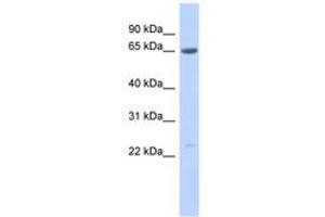 Image no. 1 for anti-Synovial Sarcoma, X Breakpoint 7 (SSX7) (AA 107-156) antibody (ABIN6743585)