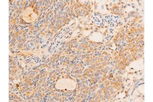 Image no. 1 for anti-Tumor Protein P73 (TP73) (pTyr99) antibody (ABIN6256817)