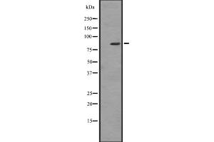 Image no. 1 for anti-Zinc Finger and BTB Domain Containing 16 (ZBTB16) (Internal Region) antibody (ABIN6257421)