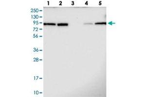 Image no. 1 for anti-Transducin (Beta)-Like 3 (TBL3) antibody (ABIN5589242)