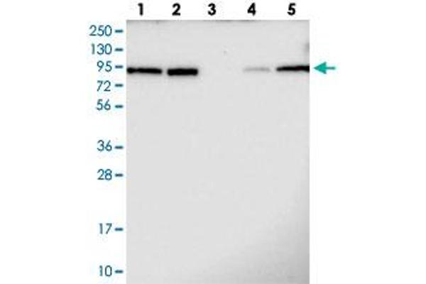 anti-Transducin (Beta)-Like 3 (TBL3) antibody