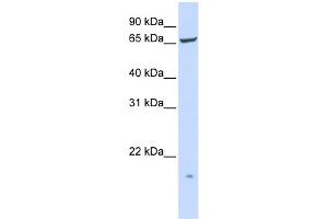 Image no. 1 for anti-Phosphatidylinositol Glycan T (PIGT) (N-Term) antibody (ABIN2782864)