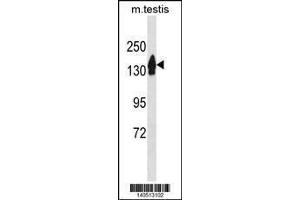 Image no. 1 for anti-RecQ Protein-Like 4 (RECQL4) (AA 1134-1162), (C-Term) antibody (ABIN1881738)