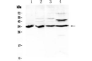 Image no. 1 for anti-Breast Cancer Metastasis Suppressor 1 (BRMS1) (AA 52-244) antibody (ABIN5518814)