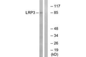 Image no. 1 for anti-Low Density Lipoprotein Receptor-Related Protein 3 (LRP3) (AA 17-66) antibody (ABIN1535012)