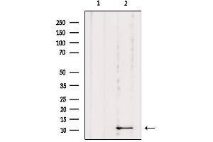 Image no. 2 for anti-Dynein, Light Chain, Roadblock Type 1 (DYNLRB1) (Internal Region) antibody (ABIN6261395)
