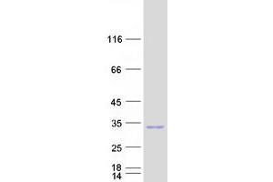 Image no. 1 for rho Family GTPase 3 (RND3) protein (Myc-DYKDDDDK Tag) (ABIN2731005)