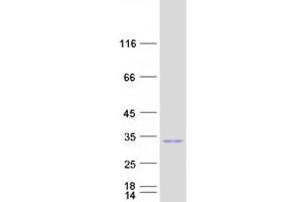 RND3 Protein (rho Family GTPase 3) (Myc-DYKDDDDK Tag)