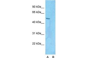 Image no. 8 for anti-PDZ and LIM Domain 5 (PDLIM5) (N-Term) antibody (ABIN2780775)