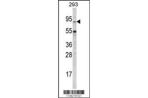 Image no. 1 for anti-ATP-Binding Cassette, Sub-Family G (WHITE), Member 1 (ABCG1) (AA 359-387) antibody (ABIN390433)