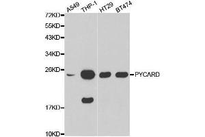 Image no. 1 for anti-PYD and CARD Domain Containing (PYCARD) antibody (ABIN3021617)