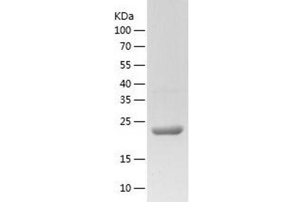 MRRF Protein (AA 56-262) (His tag)