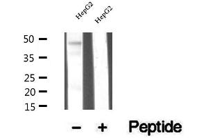 Western blot analysis of extracts of HepG2 cells, using TRBP antibody.