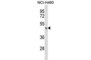 Image no. 2 for anti-Carbohydrate (N-Acetylglucosamine 6-O) Sulfotransferase 6 (CHST6) (AA 303-333), (C-Term) antibody (ABIN951521)