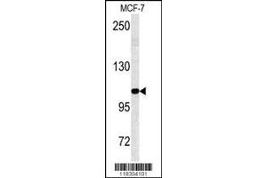 Image no. 1 for anti-KIAA0226 (KIAA0226) (AA 241-271), (N-Term) antibody (ABIN388583)