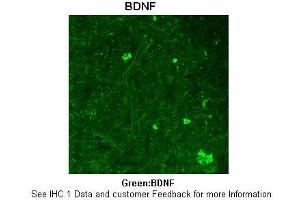 Image no. 2 for anti-Brain-Derived Neurotrophic Factor (BDNF) (Middle Region) antibody (ABIN2777093)
