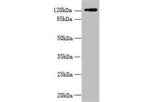 SLC4A8 Antikörper  (AA 1-300)