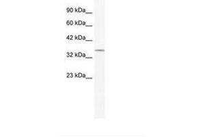 Image no. 1 for anti-POU Class 2 Homeobox 3 (POU2F3) (N-Term) antibody (ABIN202523)