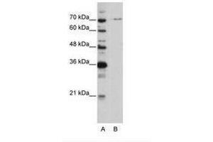 Image no. 1 for anti-PRP3 Pre-mRNA Processing Factor 3 Homolog (PRPF3) (AA 63-112) antibody (ABIN6736204)