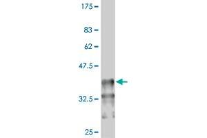 Image no. 1 for anti-Pre-B-Cell Leukemia Homeobox Protein 1 (PBX1) (AA 311-403) antibody (ABIN518648)