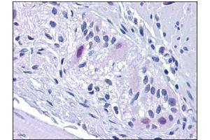 Image no. 2 for anti-Retinoblastoma Binding Protein 8 (RBBP8) antibody (ABIN784052)