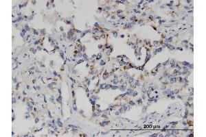 Image no. 5 for anti-Glutathione S-Transferase mu 2 (Muscle) (GSTM2) (AA 90-189) antibody (ABIN516230)