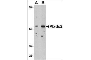 Image no. 2 for anti-Plexin Domain Containing 2 (PLXDC2) (N-Term) antibody (ABIN500515)