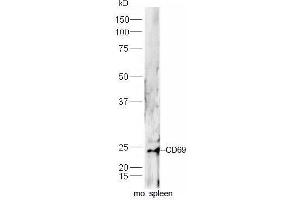 Image no. 4 for anti-CD69 (CD69) (AA 101-199) antibody (ABIN741150)
