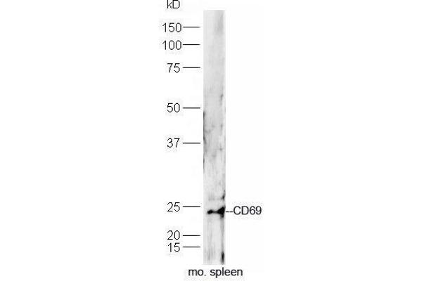 CD69 抗体  (AA 101-199)
