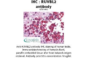 Image no. 2 for anti-RuvB-Like 2 (E. Coli) (RUVBL2) (AA 304-458) antibody (ABIN1738977)