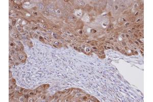 IDI1 antibody  (Center)
