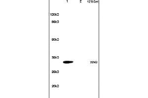 Image no. 1 for anti-Tumor Necrosis Factor Receptor Superfamily, Member 13B (TNFRSF13B) (AA 21-120) antibody (ABIN680488)