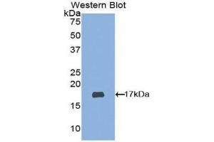 Image no. 1 for anti-ADAM Metallopeptidase with Thrombospondin Type 1 Motif, 2 (Adamts2) (AA 474-610) antibody (ABIN1077725)