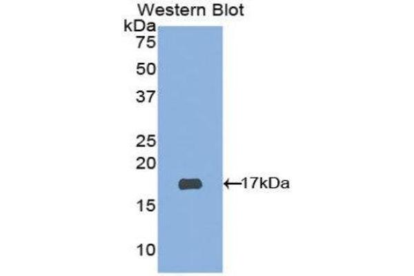 anti-ADAM Metallopeptidase with Thrombospondin Type 1 Motif, 2 (Adamts2) (AA 474-610) antibody