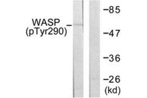 Western blot analysis of extracts from HepG2 cells, using WASP (Phospho-Tyr290) Antibody.