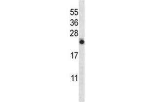 IL-13 antibody western blot analysis in NCI-H460 lysate