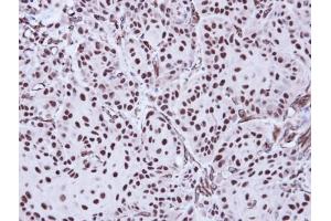 Image no. 1 for anti-Apoptosis Enhancing Nuclease (AEN) (C-Term) antibody (ABIN2856844)