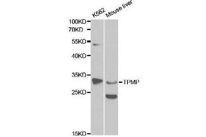Western blot analysis of extracts of various cell lines, using TPMT antibody.
