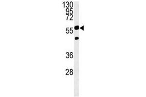 Image no. 5 for anti-phosphoglycerate Dehydrogenase (PHGDH) (AA 249-277) antibody (ABIN3032220)