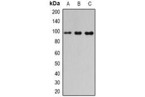 Image no. 1 for anti-phosphodiesterase 6B, CGMP-Specific, Rod, beta (PDE6B) (full length) antibody (ABIN6005498)