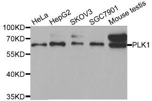 Image no. 6 for anti-Polo-Like Kinase 1 (PLK1) antibody (ABIN3023352)