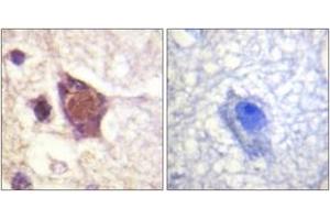 Immunohistochemistry analysis of paraffin-embedded human brain, using DDX3/DEAD-box Protein 3 (Phospho-Thr322) Antibody.