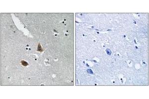 Image no. 2 for anti-Mitochondrial Ribosomal Protein L21 (MRPL21) (AA 131-180) antibody (ABIN1534524)